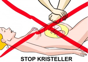 kristeller